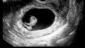 Embryology in the Quran, Quran and embryology, Embryonic stages in Quran, Human development in Islam, Stages of fetus in Quran